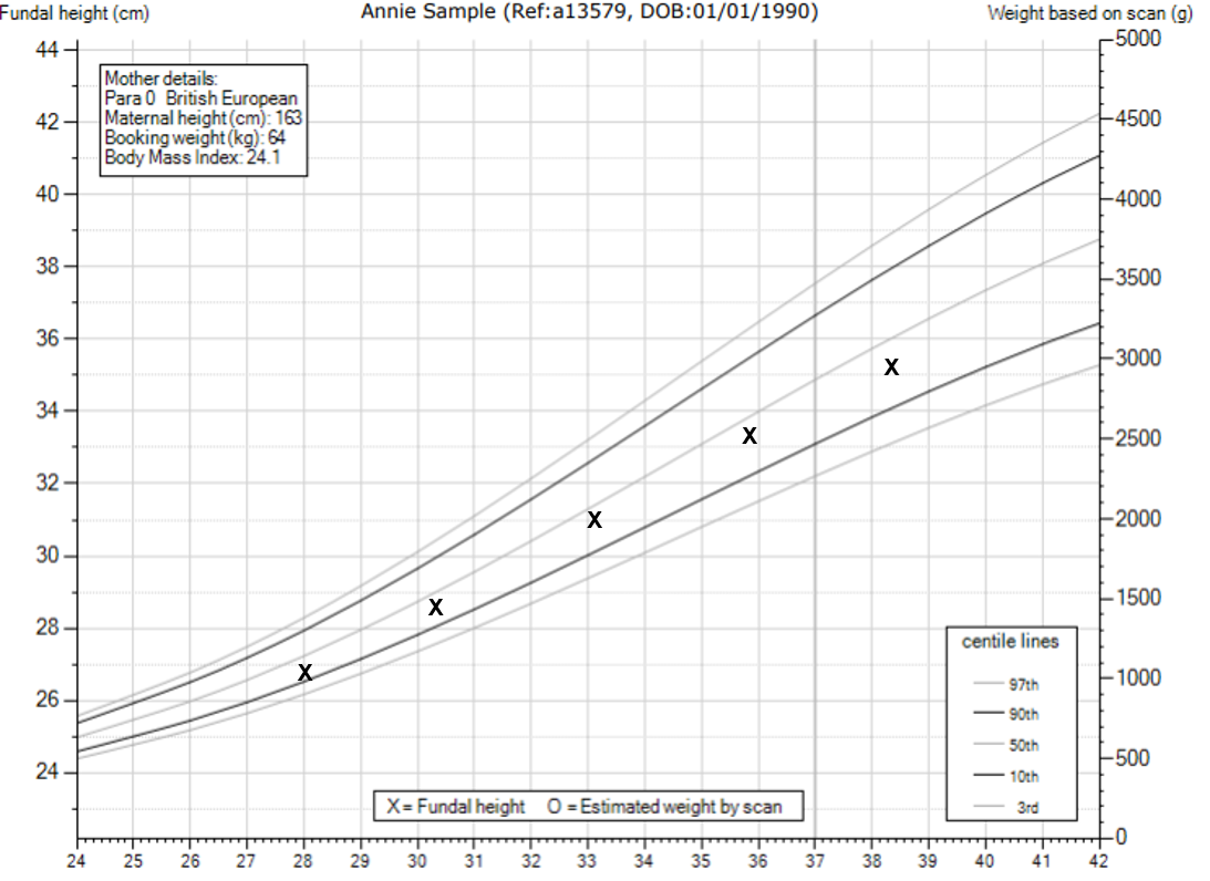 Fetal Weight Chart Uk